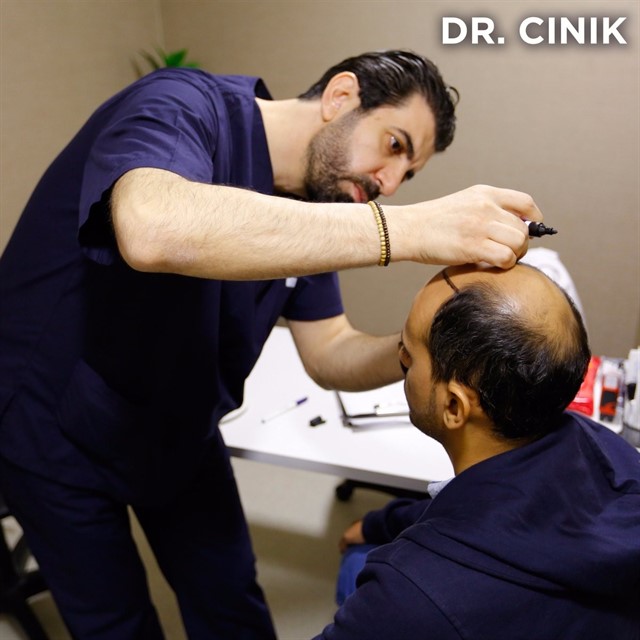 ماهو افضل مركز لزراعة الشعر في تركيا