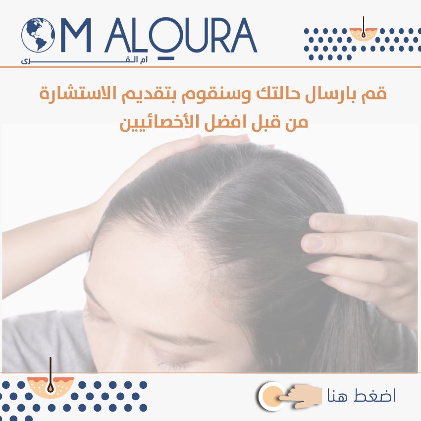 كم تكلفة زراعة الشعر في تركيا