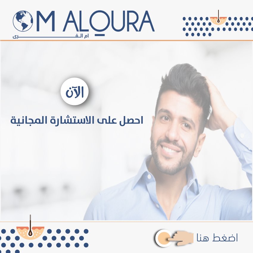 افضل دكتور زراعة شعر في تركيا